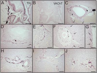 Loss of Sympathetic Nerves in Spleens from Patients with End Stage Sepsis